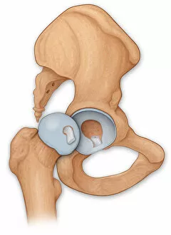 Human Internal Organ Collection: Normal anatomy of an open hip showing the articular surface of the femur