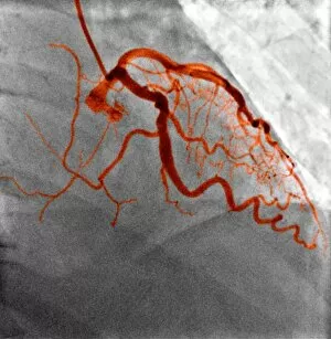 Scientific Gallery: Normal blood vessels, X-ray