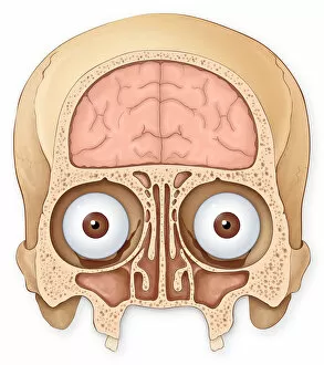 Normal coronal section of the skull and brain showing the coronal sinuses