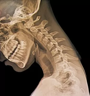 Science And Technology Gallery: Normal flexed neck, X-ray