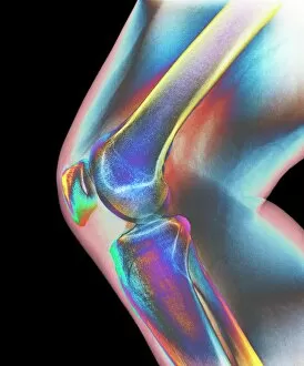 Mid Adult Collection: Normal knee, X-ray