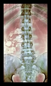 Science And Technology Gallery: Normal spine, X-ray