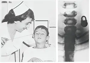 Schenectady Prints: Nurse and X-Ray Showing Lock