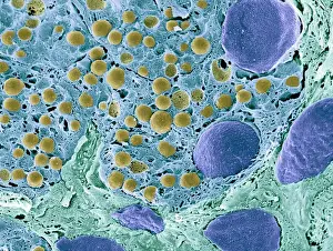 Pancreas tissue, colored scanning electron micrograph
