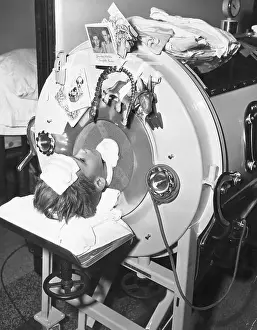 Poliomyelitis Prints: Patient Lying in Iron Lung