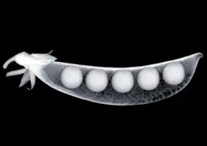 Detailed View Collection: Five peas in a pod, X-ray