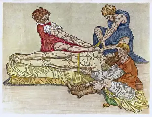 Physician and Assistants Preparing a Dislocated Shoulder