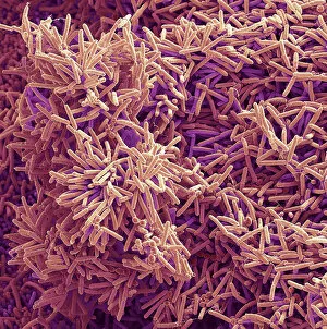 Plaque-forming bacteria, SEM