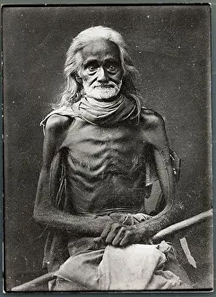 Starvation Prints: Portrait of Emaciated Man