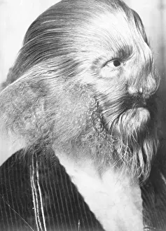 Portrait of a Genetically Hairy Man