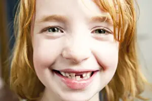 Tooth Prints: Portrait of a girl with red hair with a missing tooth