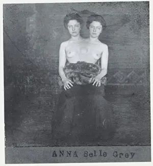 Portrait of Siamese Twins