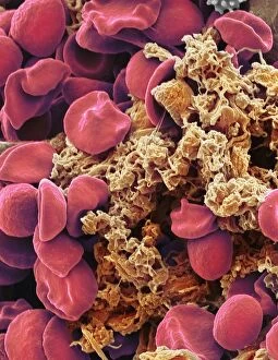 Images Dated 11th November 2018: Red blood cells and platelets, SEM