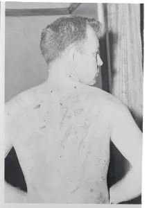 Paul Prints: Scarred Back of Suspected Religious Sect Murderer