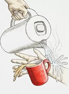 Scolding by accidentally pouring boiling hot water from modern kettle onto arm, causing mug of coffee to fall