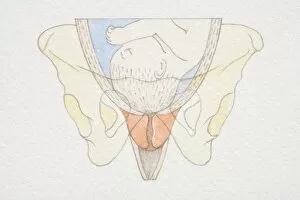 Images Dated 30th June 2006: Section diagram of swollen uterus with foetus head pushing down on cervix opening