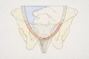 Images Dated 30th June 2006: Section diagram of swollen uterus with foetus head pushing down on cervix opening
