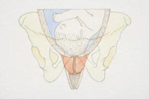 Delivery Prints: Section diagram of swollen uterus with foetus head pushing down on cervix opening