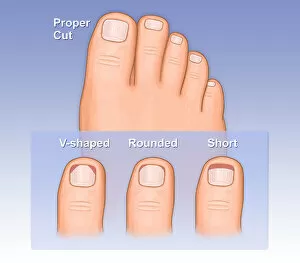 Human Internal Organ Collection: Showing a proper way to cut toe nails versus and improper way, shown as a rounded cut