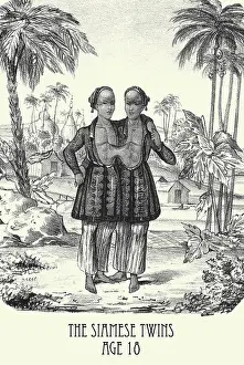 Twins Prints: The Siamese Twins age 18
