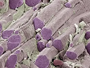 Skeletal muscle fibers, colored scanning electron micrograph (SEM)