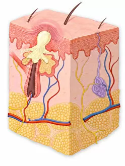 Images Dated 4th June 2012: Skin cross section showing a papule