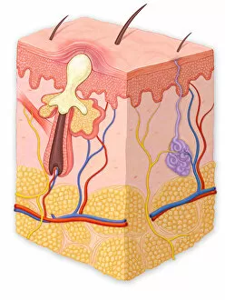 Images Dated 4th June 2012: Skin cross section showing a whitehead