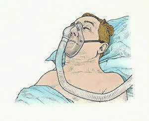 Dorling Kindersley Prints Collection: A sleep apnea patient with mask