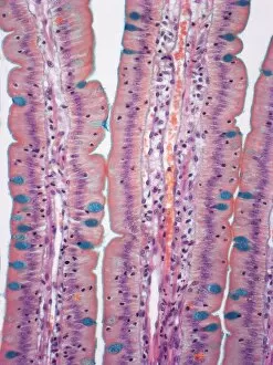 Vertical Image Gallery: Small intestine, LM