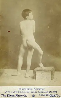 Time Captured: Vintage Art: Souvenir Cabinet Card of Three-Legged Boy, Francisco Lentini, circa 1890