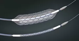 Heart Gallery: Stents and balloon catheters, illustration