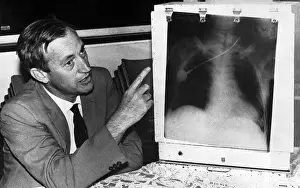 X Ray Prints: Surgeon Explaining First Heart Transplant