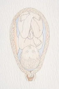 Delivery Prints: Swollen womb with inverted foetus head pointing to cervix opening