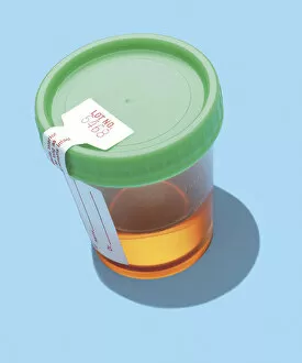 Images Dated 21st August 2013: Urine Sample