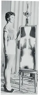 Woman Posing Next to Skeleton X-Ray
