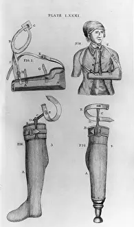 Prints And Engravings Prints: Wooden Limbs