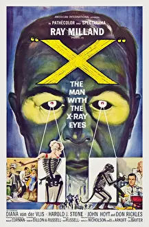 X Ray Prints: X: The Man with the X-ray Eyes