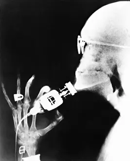 Strange Prints: X-Ray Of Man Shaving With Electric Razor